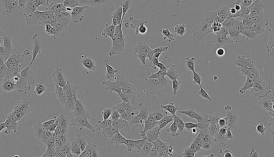 NCI-H841人小細(xì)胞肺癌貼壁細(xì)胞系的應(yīng)用！