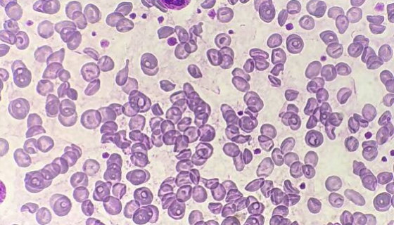 4%雞紅細胞的分離鑒定及其生物學特性研究！