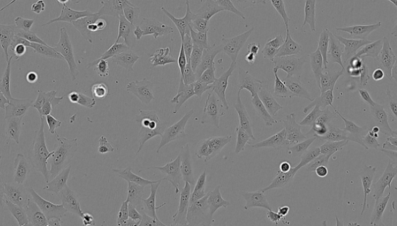 小鼠胃平滑肌細胞的知識與培養(yǎng)操作步驟及應(yīng)用！