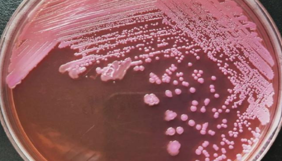 志賀氏菌屬通用PCR試劑盒的操作步驟及研制與應(yīng)用！