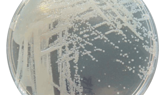 臨床常見非發(fā)酵菌的分布特征及耐藥性分析！