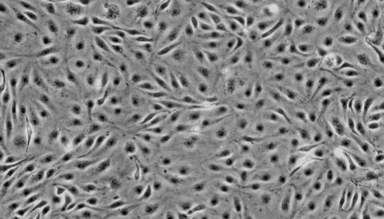小鼠脑微血管内皮细胞株的特点及其应用！