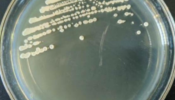 贝莱斯芽孢杆菌的拮抗功能及应用与研究进展！