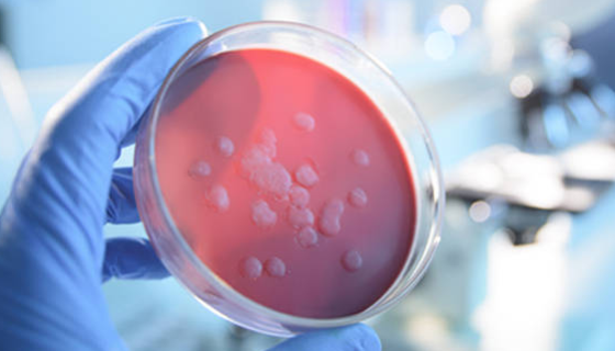 实验室物表消毒：守护无菌环境，从细节做起！