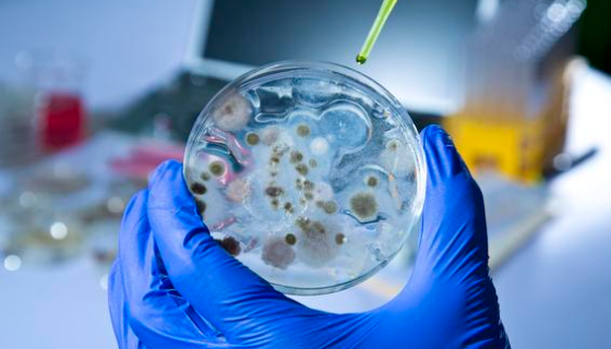 生物反应器中微生物培养条件的重要性与调控方法！
