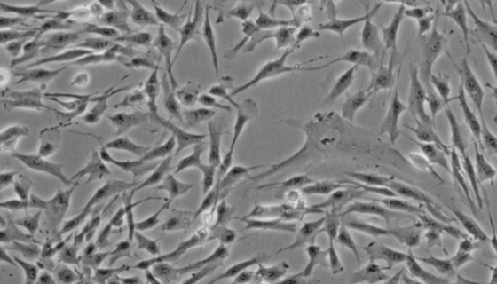 KMST-6细胞系人胚成纤维细胞的培养及应用研究！