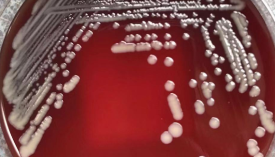 ATCC 29062 松鼠葡萄球菌 百欧博伟生物