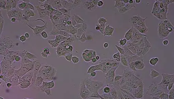 MDA-MB-435人乳腺癌细胞的性质与用途及生产工艺！