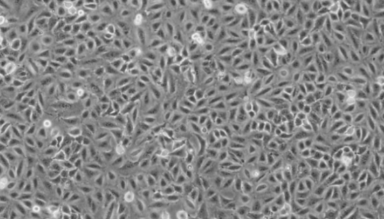 NCI-H719细胞系人小细胞肺癌细胞的知识与应用！