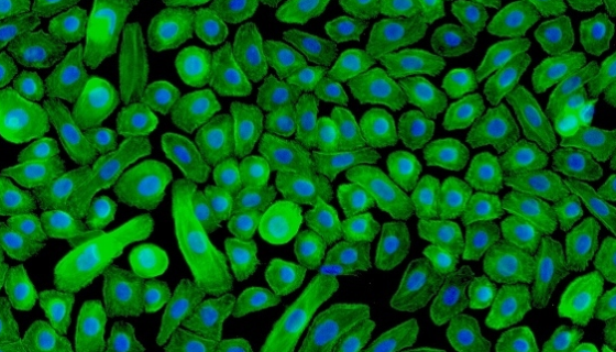 小鼠子宫内膜上皮细胞的分离和原代培养！