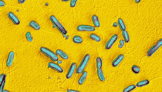 潮湿纤维单胞菌的微生物培养方法及注意事项！