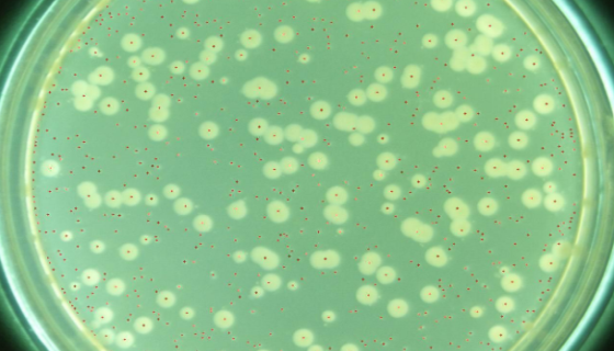 铜绿假单胞菌的实验室检查与生化鉴定及预防方法！