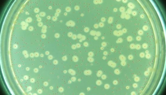 近海细菌摩氏假单胞菌的形态特征与主要价值！