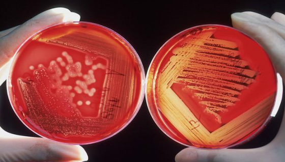 微生物实验室常用的灭菌方法之湿热灭菌法！