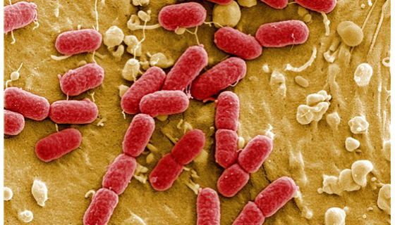 大肠杆菌发酵罐噬菌体污染的原因及预防措施！