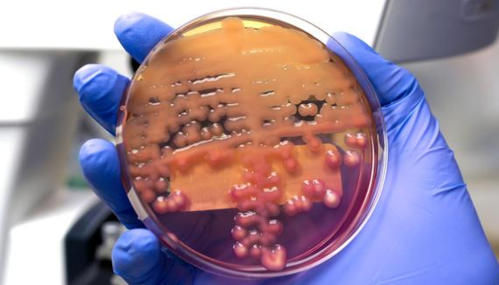 微生物培养与鉴定及药敏检测的相关术语有哪些？