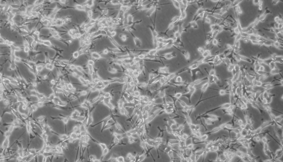小鼠卵巢颗粒细胞永生化的培养操作规程！
