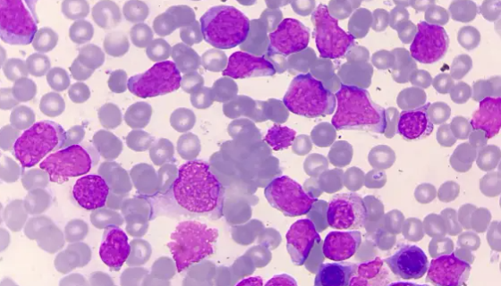 TALL-104人急性T淋巴细胞白血病细胞的培养方法！