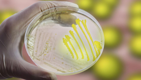 活泼微球菌的培养条件与方法及注意事项！