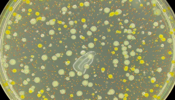 假单胞菌属：肠道有害菌属，多变且适应性强！
