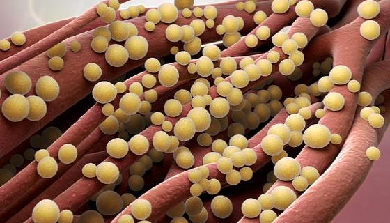 食品中金黄葡萄球菌的检测方法及操作步骤！