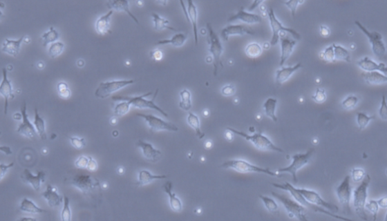 小鼠原代视网膜色素上皮细胞的运输和保存及使用！