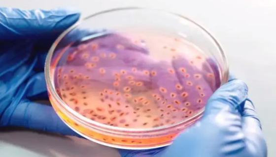 食品微生物检验技术之微生物能力验证能力考核要点！