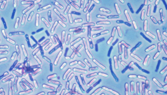 解葡聚糖微杆菌的特点与优势及微生物培养方法！
