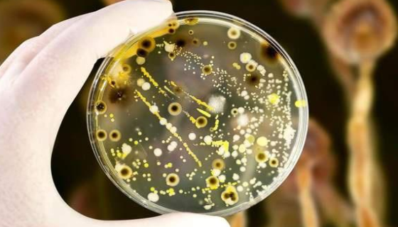 細(xì)黃鏈霉菌的形態(tài)與性狀特征及生態(tài)分布與經(jīng)濟(jì)用途！