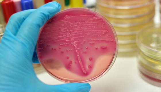 细胞培养过程中细菌污染的来源与影响及预防措施！