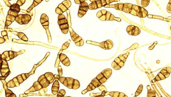 荔枝霜疫霉的病原癥狀與發(fā)生過(guò)程及防治方法！