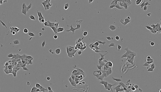 破骨細(xì)胞的背景來(lái)源與演變過(guò)程及臨床展望！