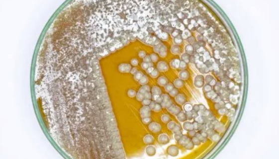 广西高温放线菌的培养方法与实验内容及注意事项！