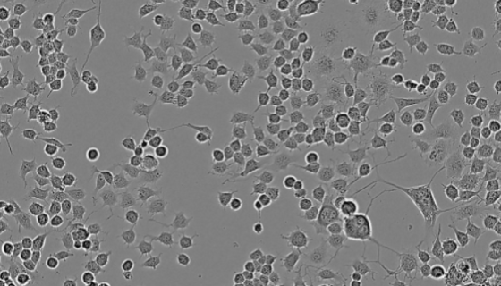 人膽道瘢痕成纖維樣細(xì)胞的處理方法與注意事項(xiàng)！