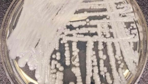 解脂假絲酵母解脂變種的形態(tài)特征與主要應(yīng)用！