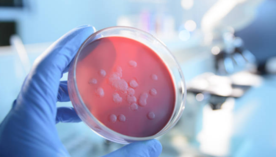 利用新型细菌快速检测技术有效监控食品细菌性污染！