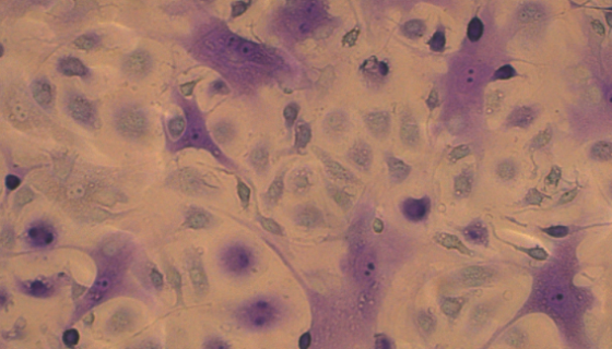 正常小鼠睾丸Sertoli细胞的处理方法与培养操作规程！