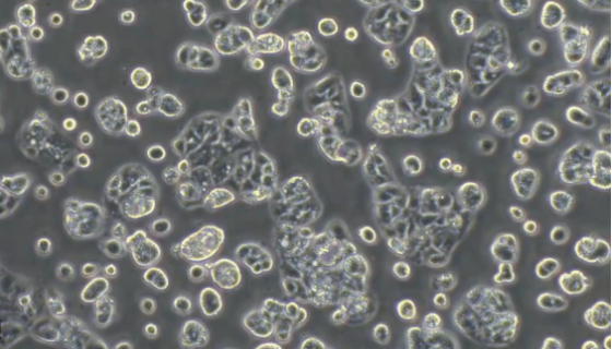 豬痢疾密螺旋體的流行病學與臨診癥狀及作用機理！