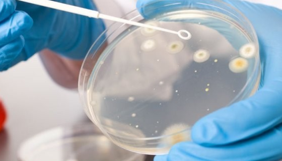 你知道如何防范冷库成为细菌和霉菌的培养皿吗？