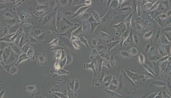 大鼠原代腎小球系膜細(xì)胞的知識與主要作用及應(yīng)用！