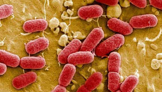 腸產(chǎn)毒素性大腸桿菌的生物特性與毒力因子及防治措施！