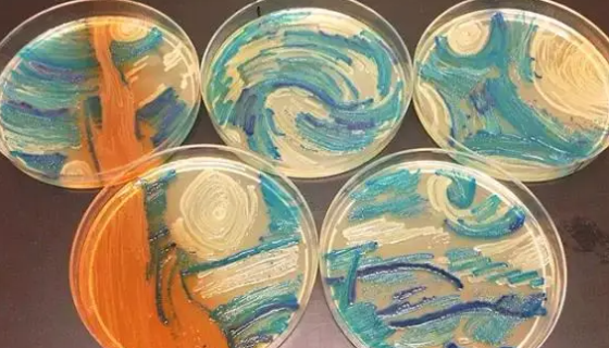 發(fā)酵培養(yǎng)基：培養(yǎng)基中C、N、P濃度對發(fā)酵結(jié)果的影響！