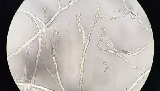 皮膚皮狀新絲孢酵母：用途為利用亞硫酸廢液培養(yǎng)飼料酵母