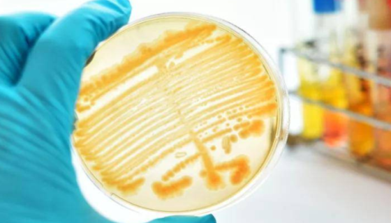 香蕉枯萎病的侵染過程與作用機制及防治方法！