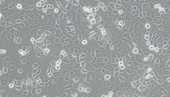 人關節(jié)滑膜成纖維細胞的性質(zhì)與用途及生產(chǎn)工藝！