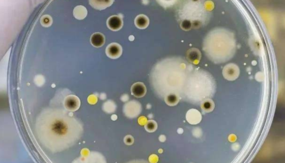 糠秕馬拉色菌的生物學特性與致病機制及治療與預(yù)防！
