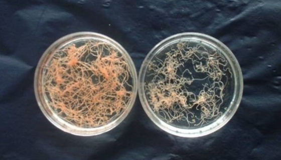 絨毛產(chǎn)線菌的生態(tài)分布與生長環(huán)境及用途與影響作用！