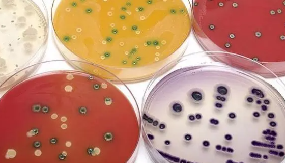 培養(yǎng)基制備實驗過程中如何保證其營養(yǎng)成分的完整性？