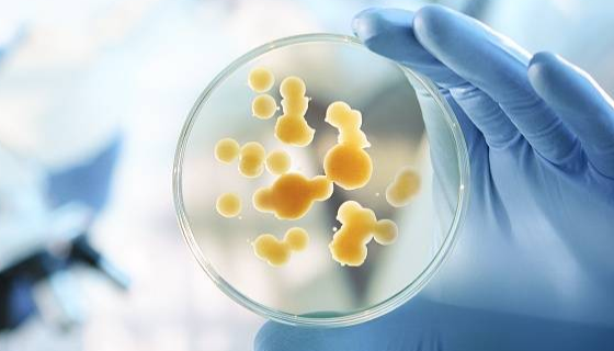 食品環(huán)境中的極端微生物難以控制的核心原因是什么？