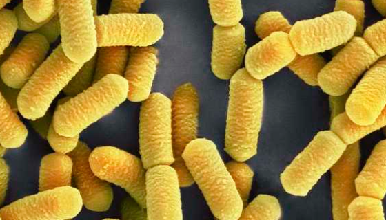 乳酸桿菌瓊脂培養(yǎng)基的保存方法及其注意事項(xiàng)有哪些？